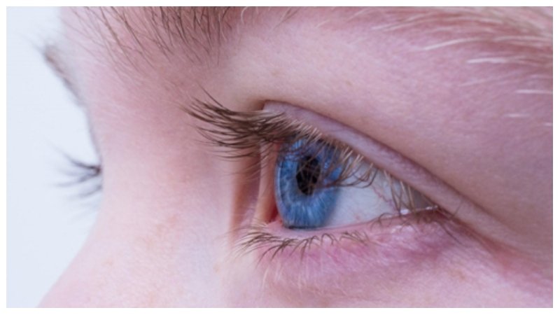 Eyelid Surgery