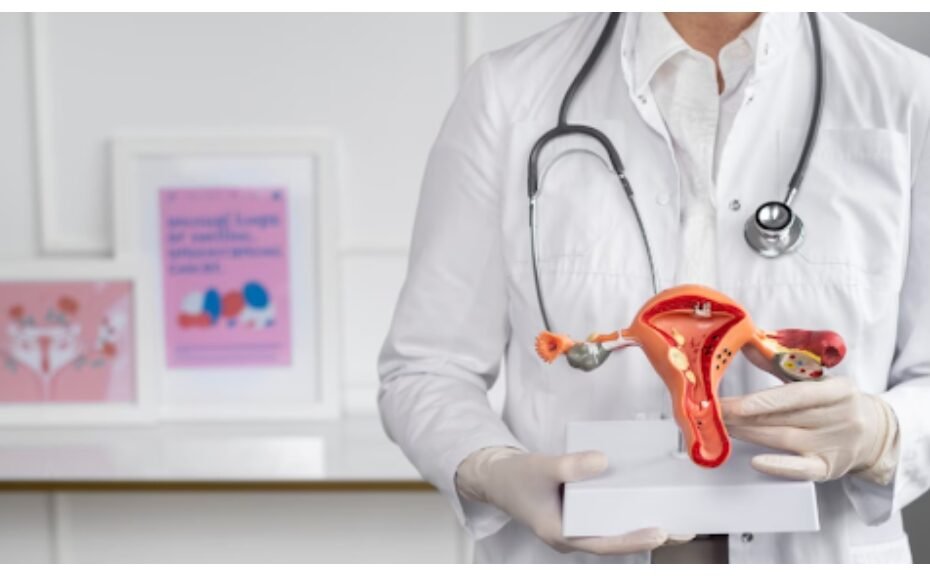 Ovarian Tumor Treatment